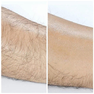 Beauty Painless Hair Removal - Trendy Planet